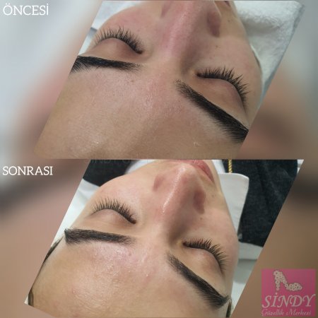 TRABZON'DA CİLT BAKIMI