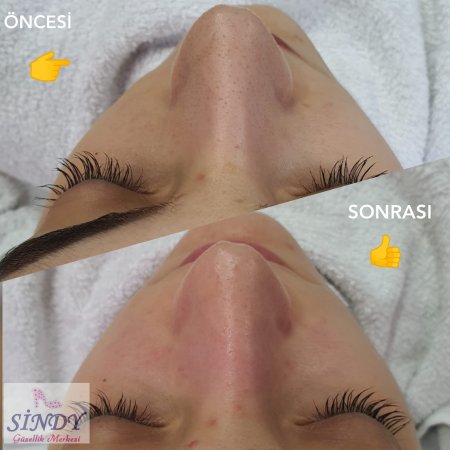 TRABZON'DA CİLT BAKIMI