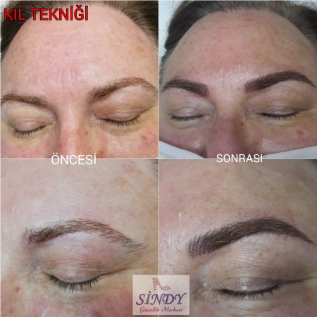 TRABZON KIL TEKNİĞİ...