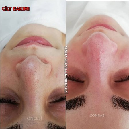 TRABZON CİLT BAKIM MERKEZİ